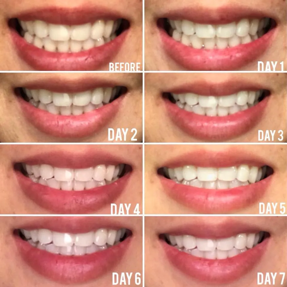 34583 sensitivity toothpaste