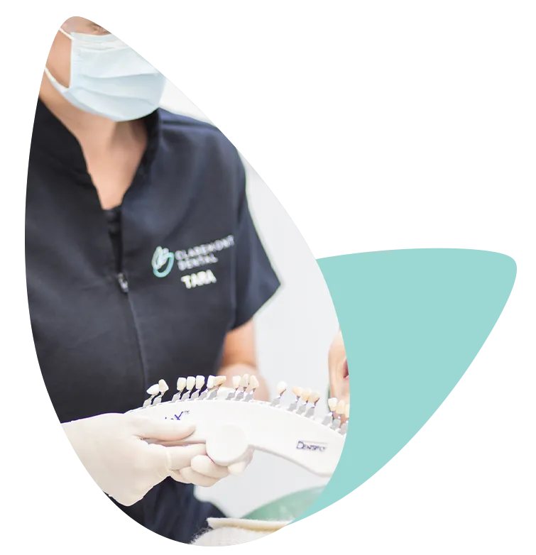 34586 teeth whitening results perth