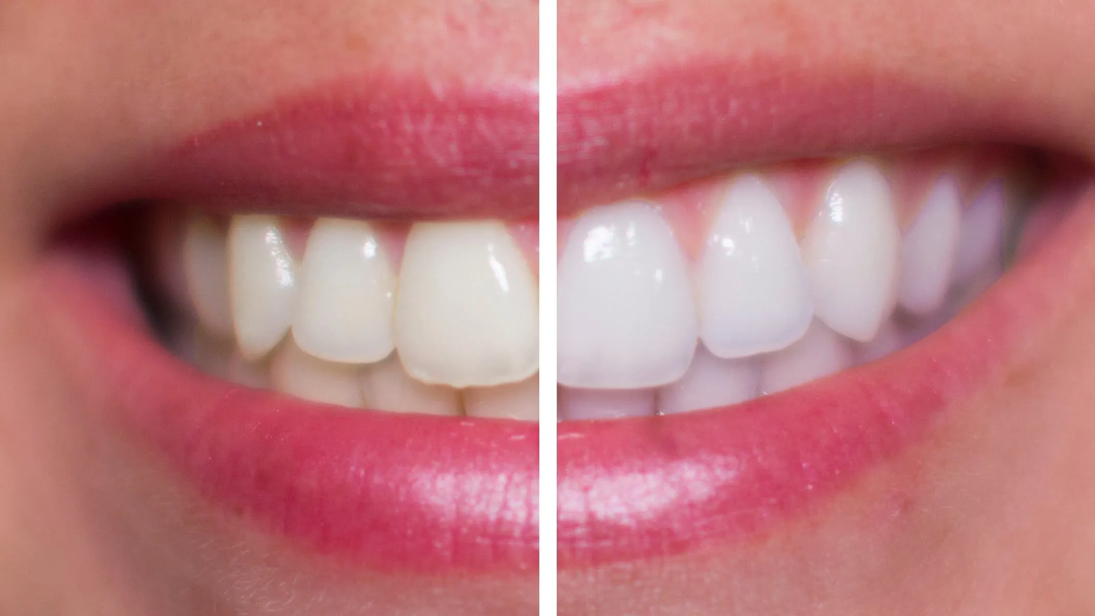 34589 oral hygiene practices