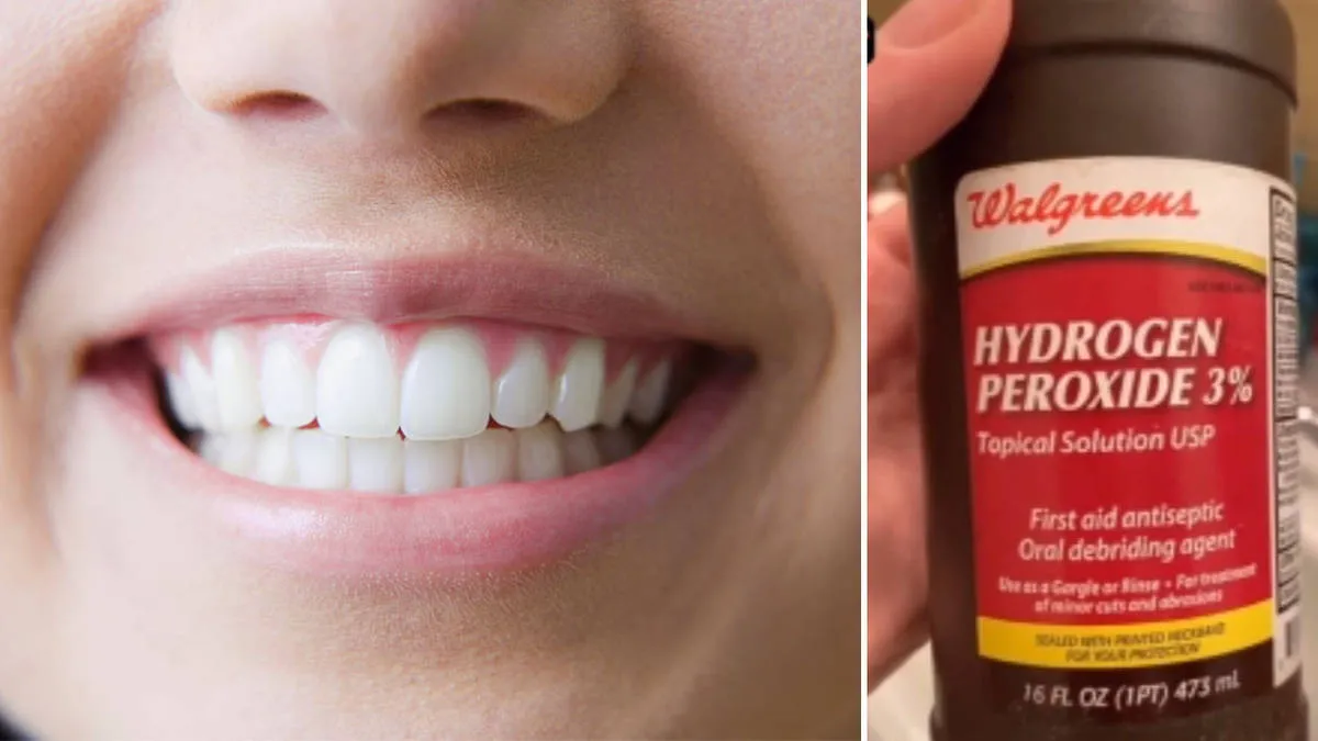 /img/34589-teeth-whitening-alternatives.webp
