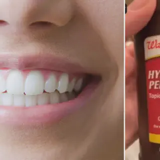 /img/34589-teeth-whitening-alternatives.webp
