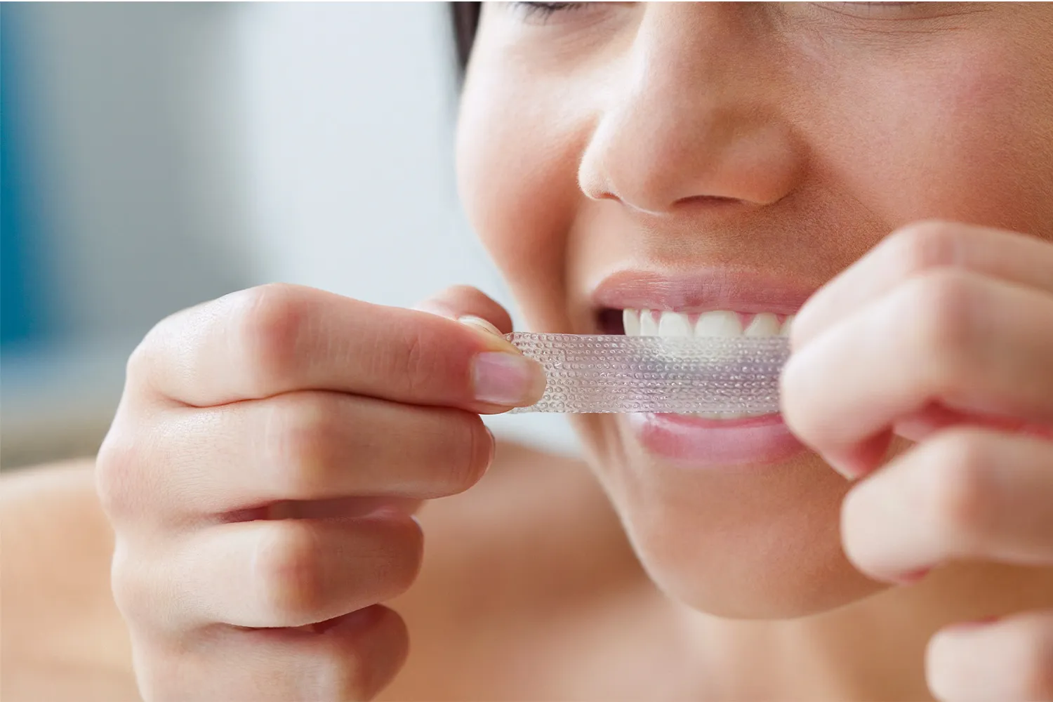 34592 professional teeth whitening