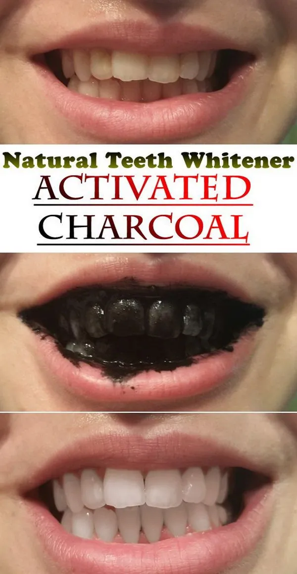 34603 activated charcoal teeth