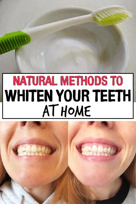 34603 brushing and flossing