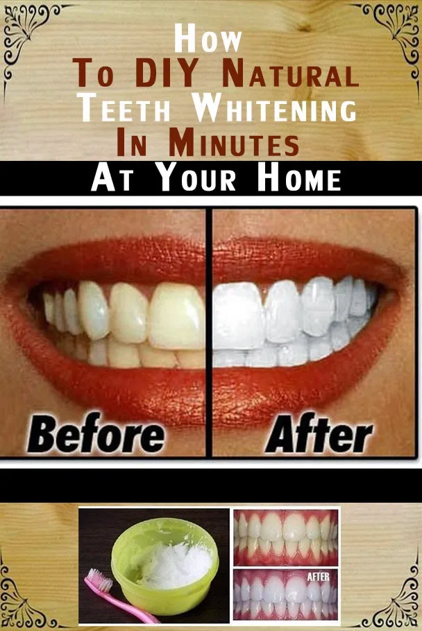 /img/34603-healthy-foods-teeth.webp