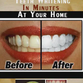 /img/34603-healthy-foods-teeth.webp