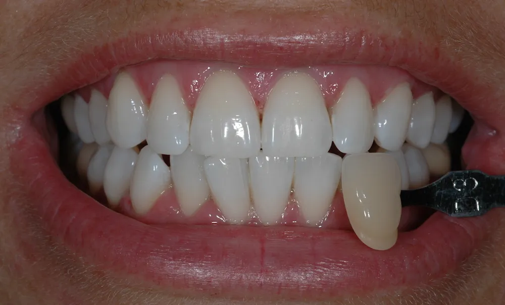 /img/34617-find-reputable-dentist-oxford.webp