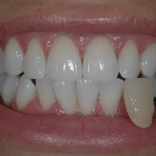 /img/34617-find-reputable-dentist-oxford.webp