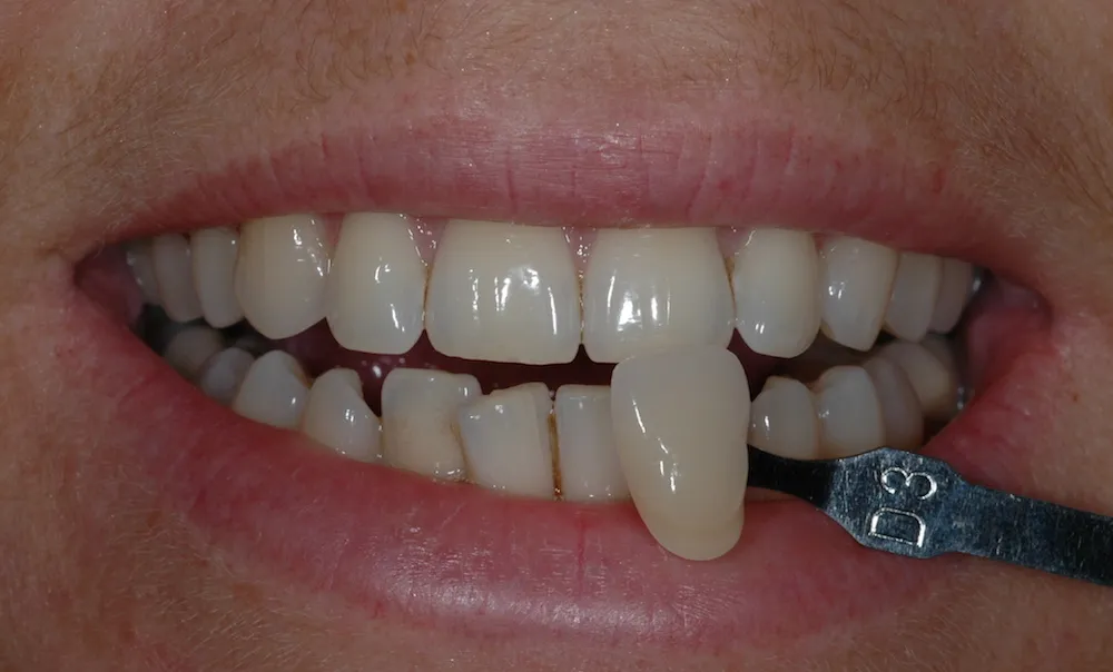 34617 maintain bright smile