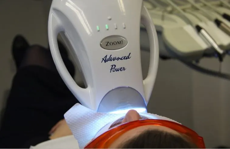 34617 types of tooth whitening