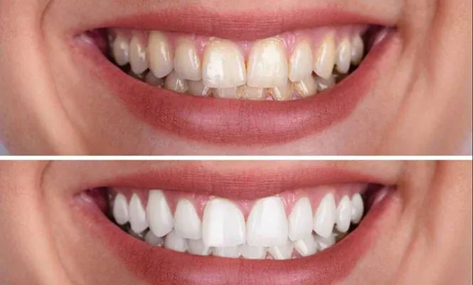 /img/34618-oral-hygiene-routine.webp