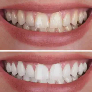 /img/34618-oral-hygiene-routine.webp