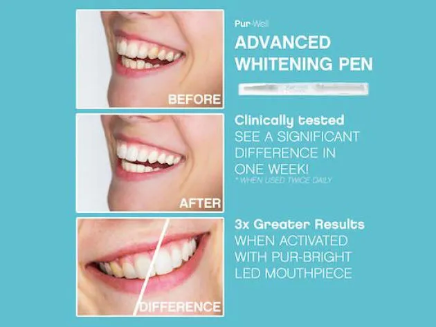 34618 teeth whitening diet