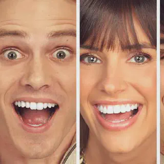 /img/34624-teeth-whitening-cost.webp