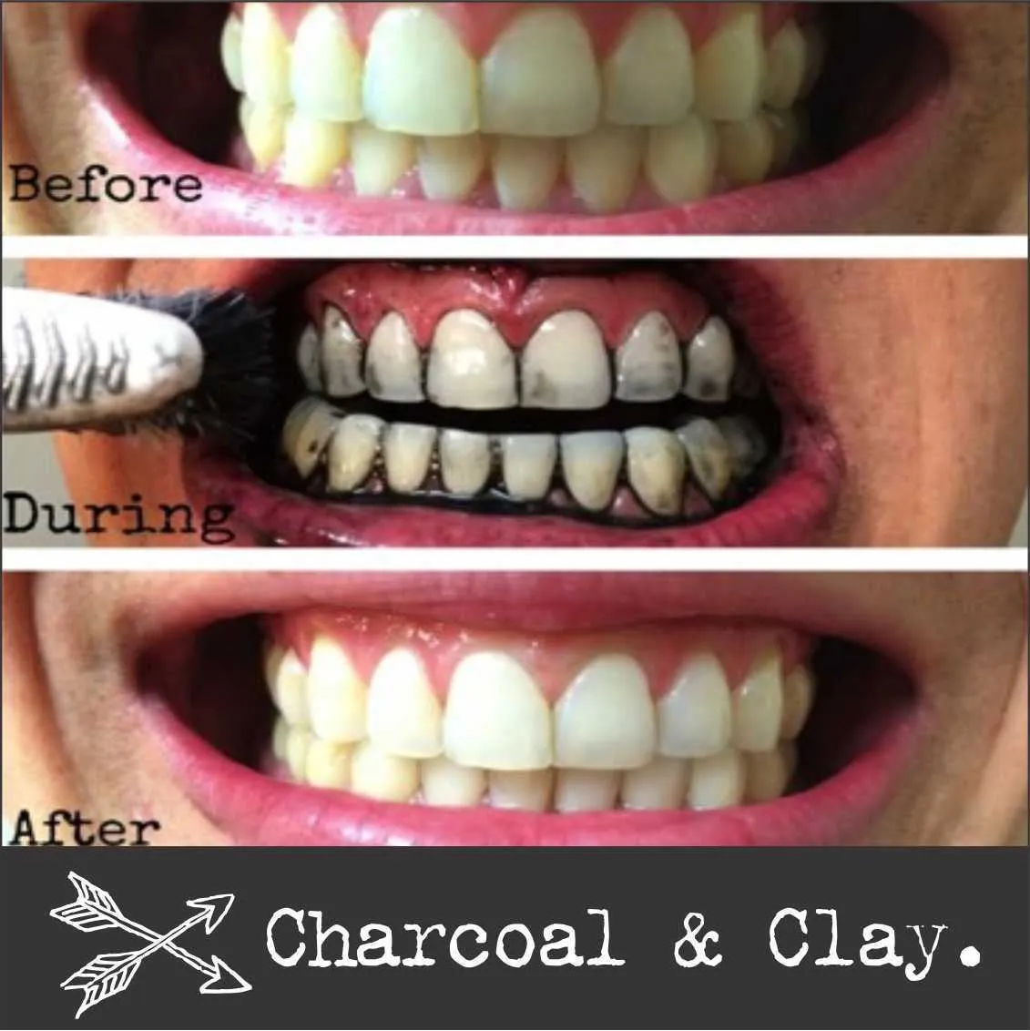 34628 choosing charcoal for whitening