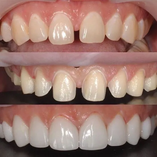 34633 dental insurance plans