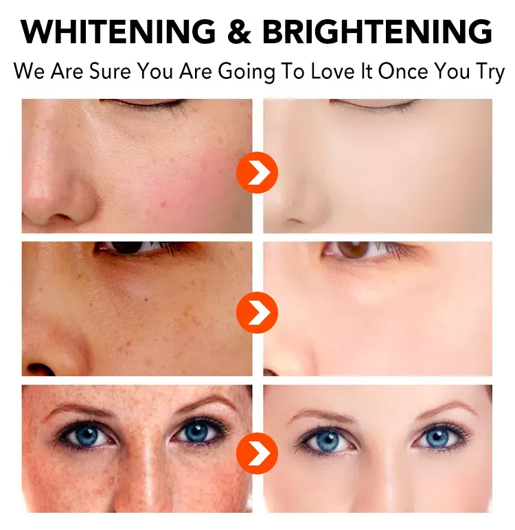 34651 esthetic blend before after