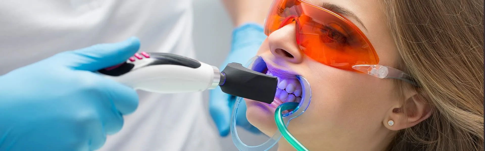34658 teeth whitening glasgow clinic