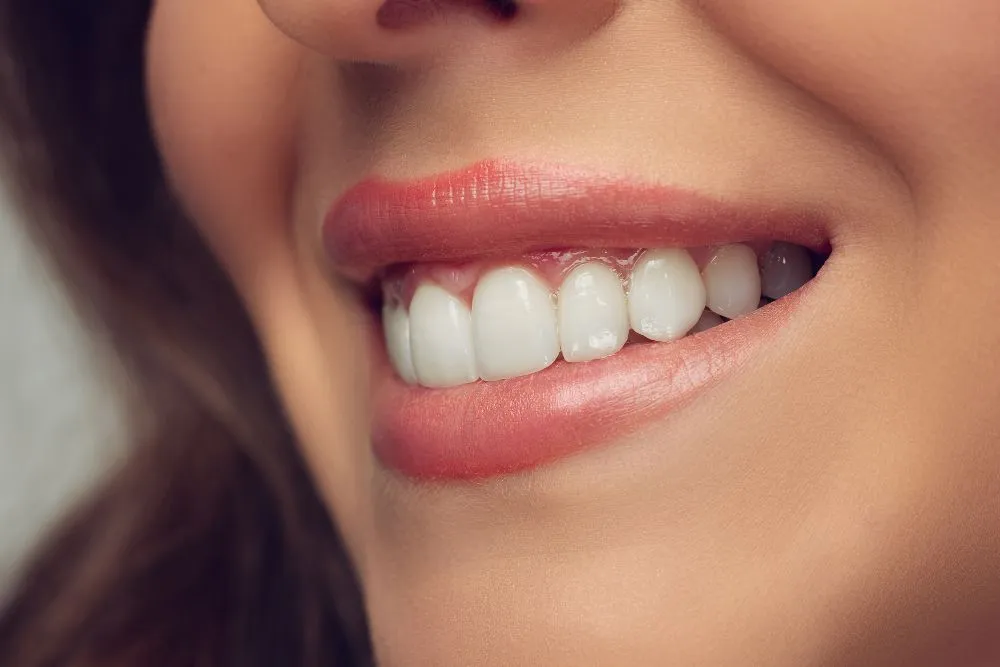 34661 at home whitening kits