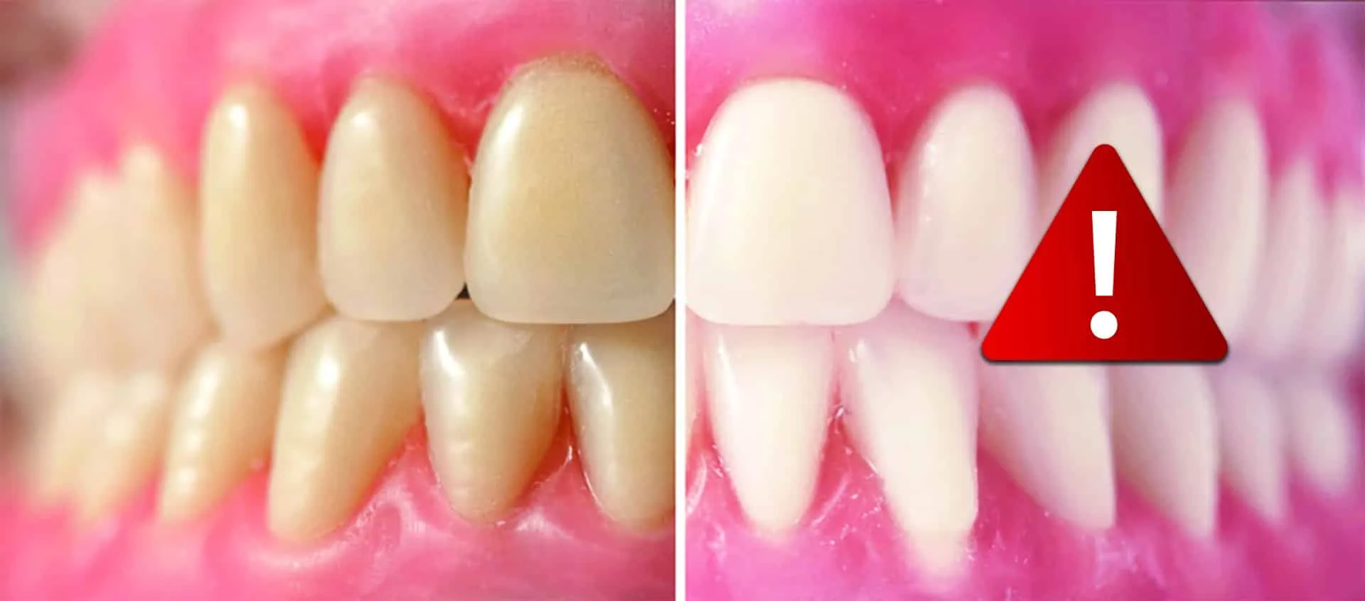 34661 protecting gums whitening