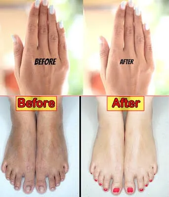 /img/34677-sunscreen-hands-feet.webp