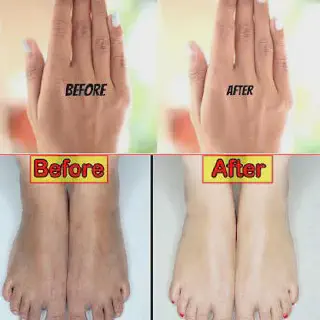 /img/34677-sunscreen-hands-feet.webp