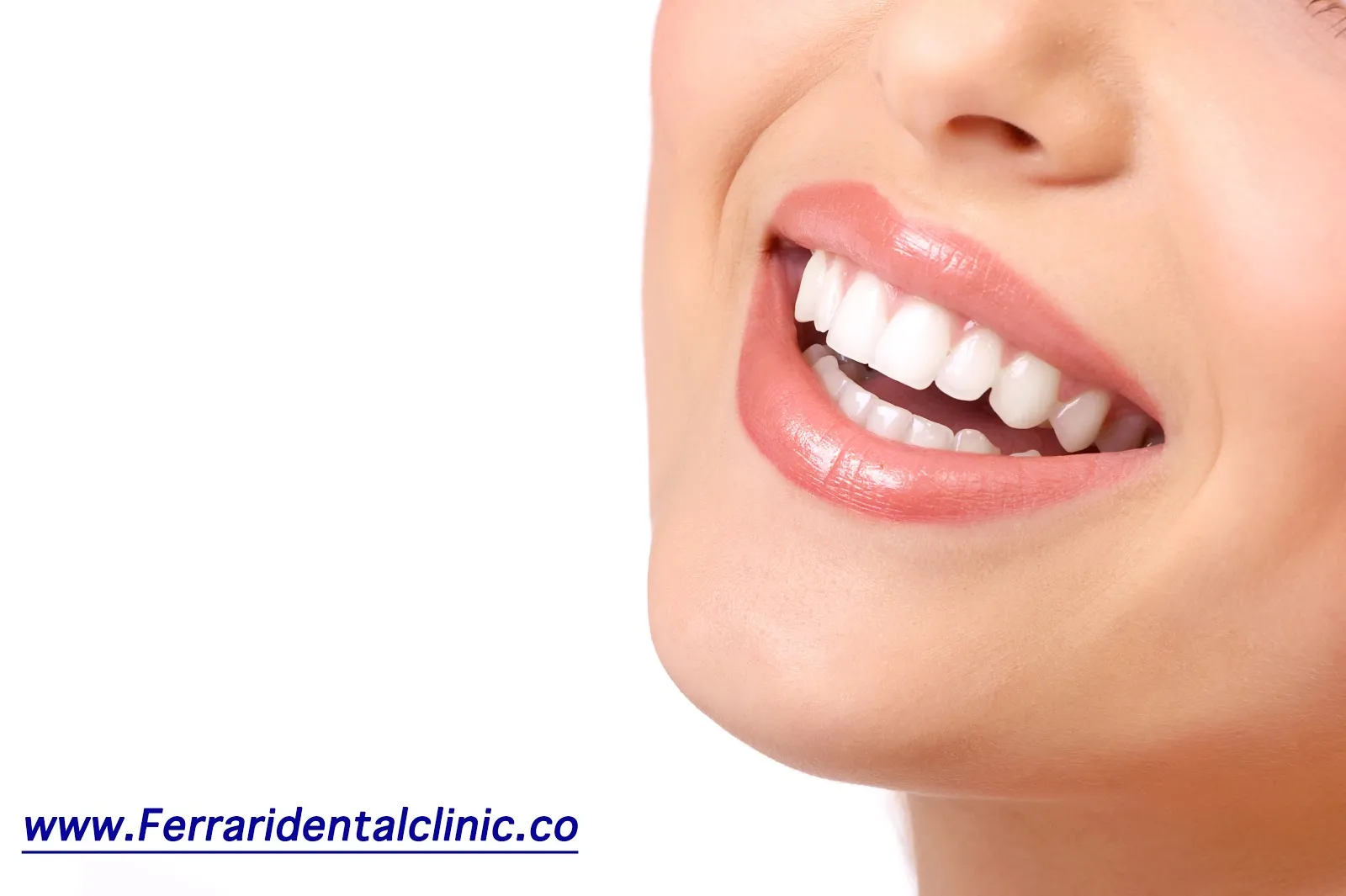 34708 teeth whitening tel aviv dental checkup