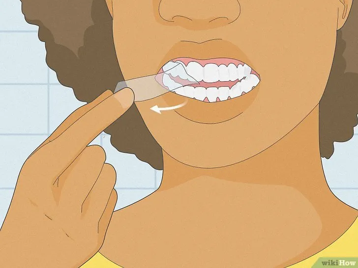 34715 sensitive teeth