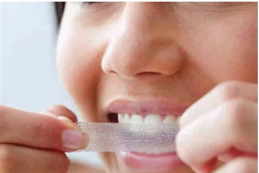 34715 teeth whitening results