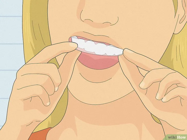 34715 whitening strips application