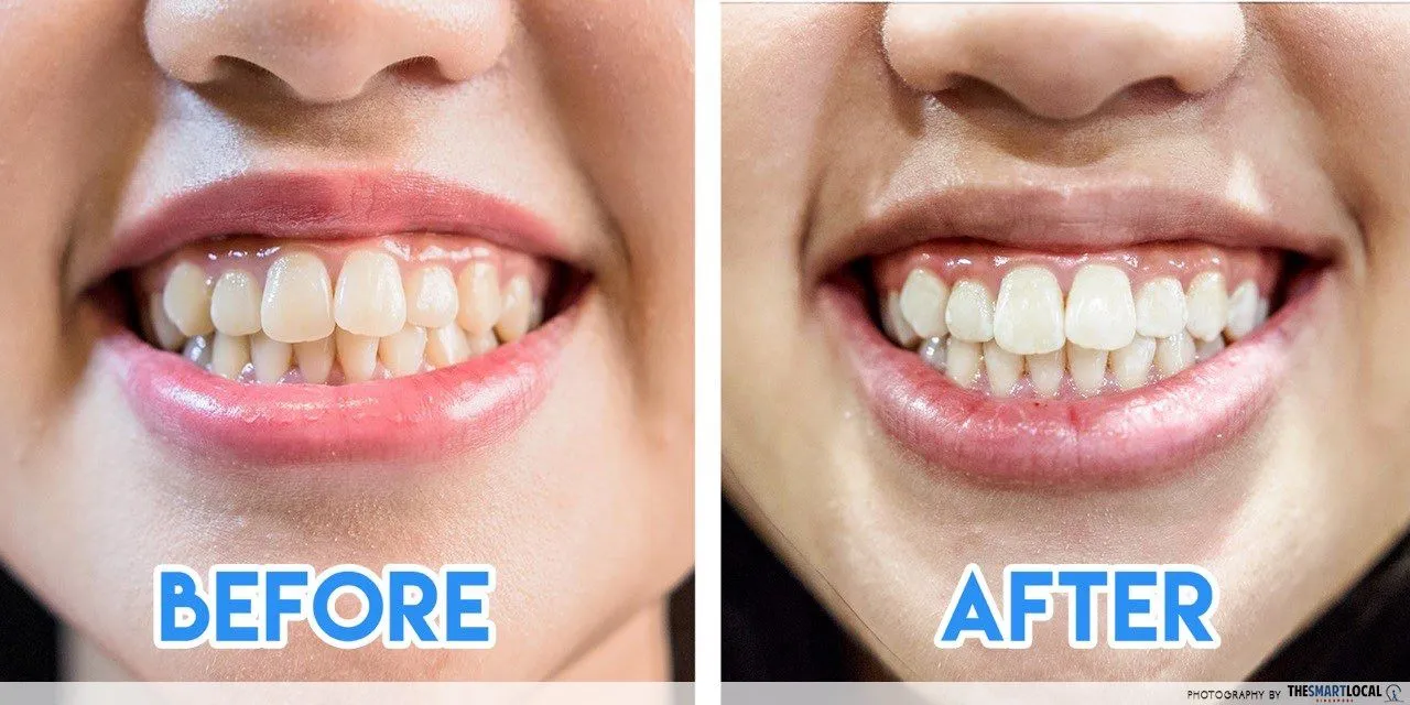 34740 avoid staining foods