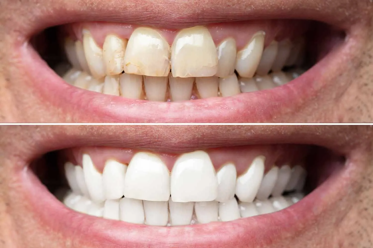 /img/34740-bright-smile.webp