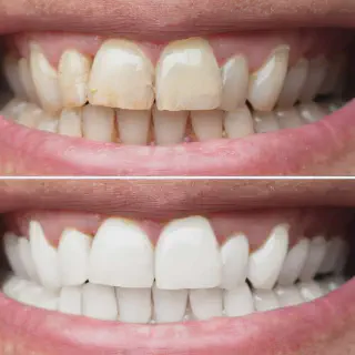 /img/34740-bright-smile.webp