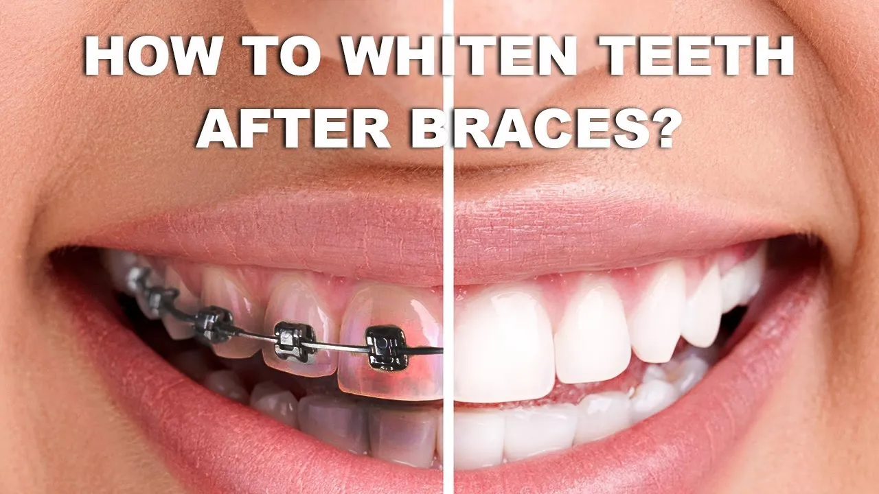 34740 oral hygiene techniques