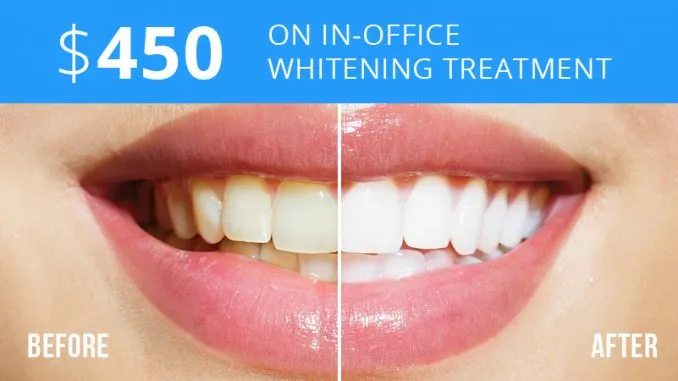 34741 dentist whitening benefits