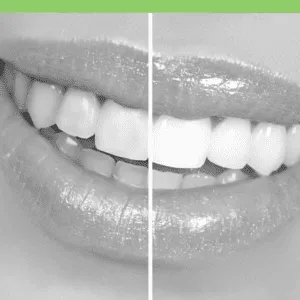 /img/34747-costa-rica-teeth-whitening-happy-patient.webp