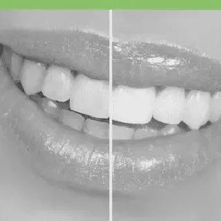 /img/34747-costa-rica-teeth-whitening-happy-patient.webp