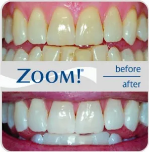 /img/34780-healthy-smile.webp