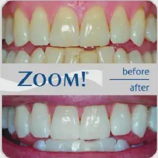 /img/34780-healthy-smile.webp
