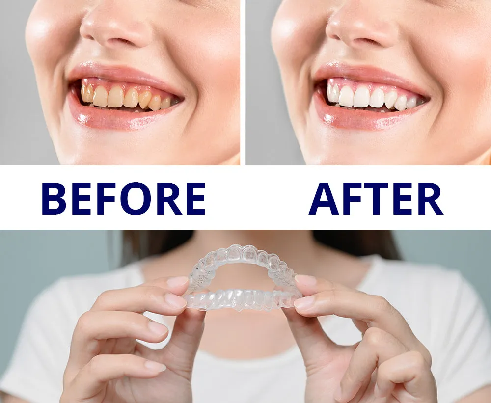 34780 teeth whitening schedule
