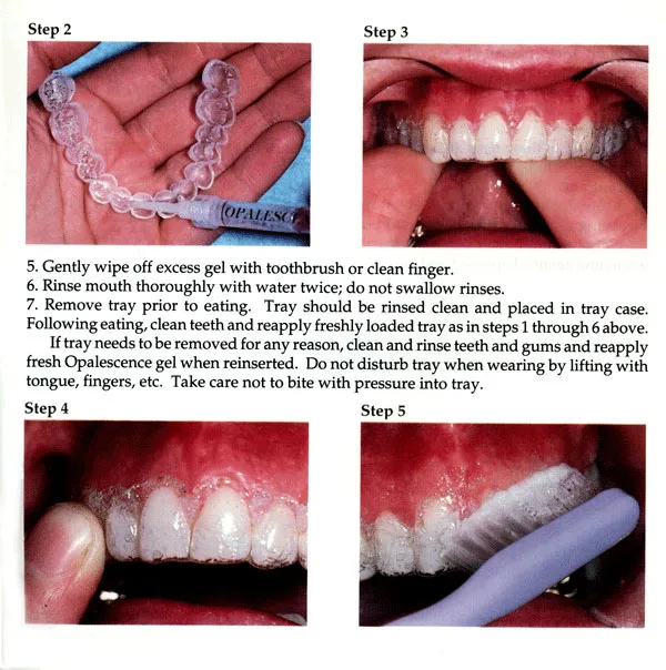 34780 tooth sensitivity