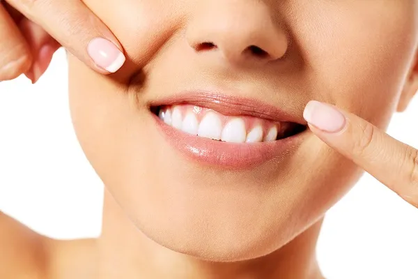 34782 teeth whitening maintaining smile