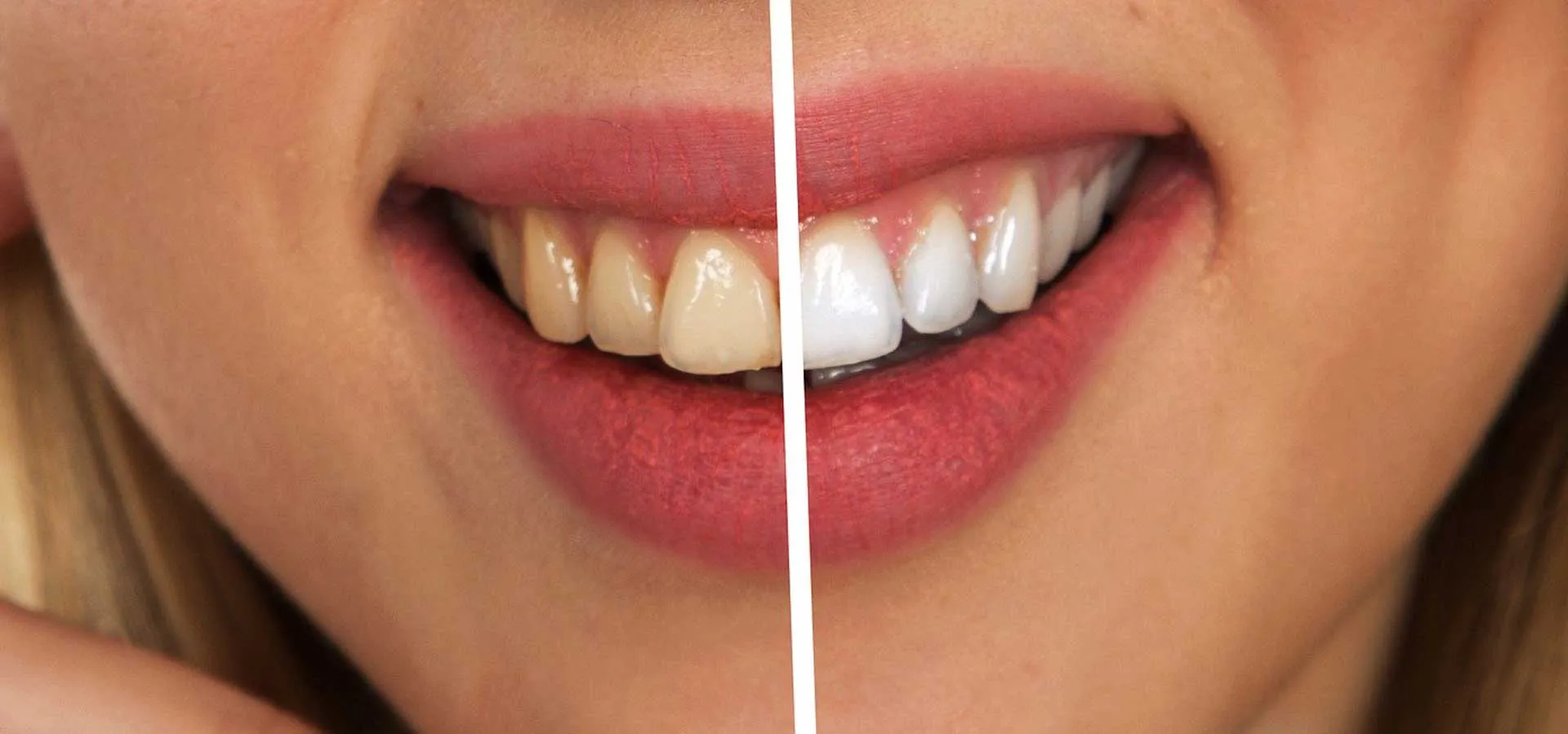 34791 whitening process