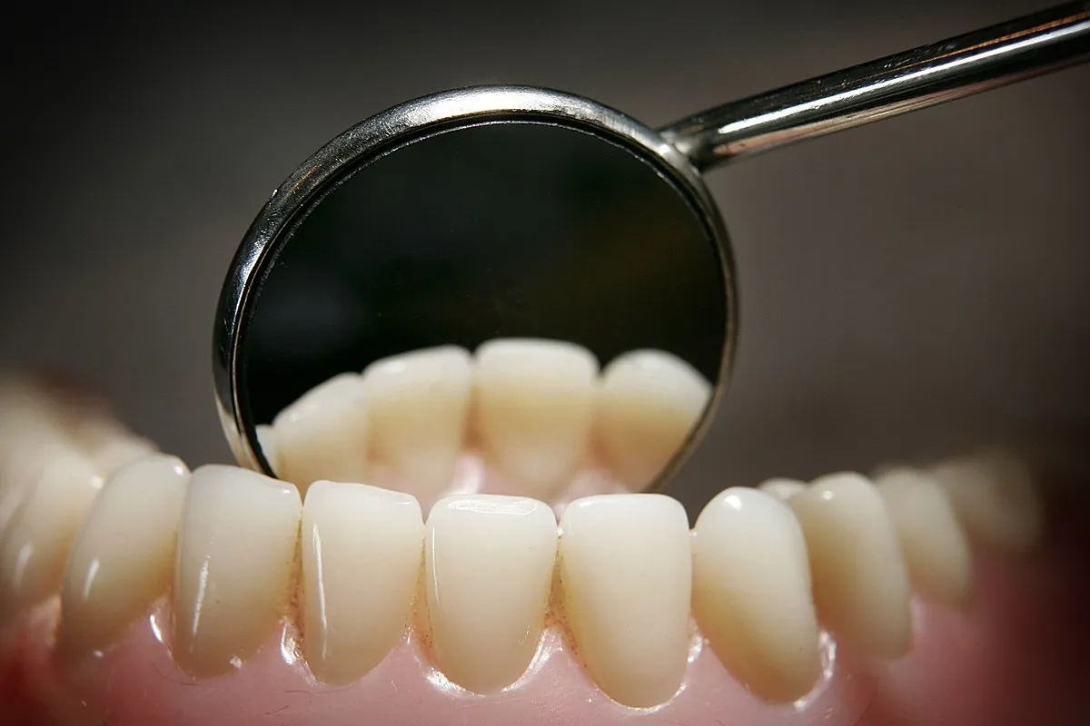34800 whitening methods