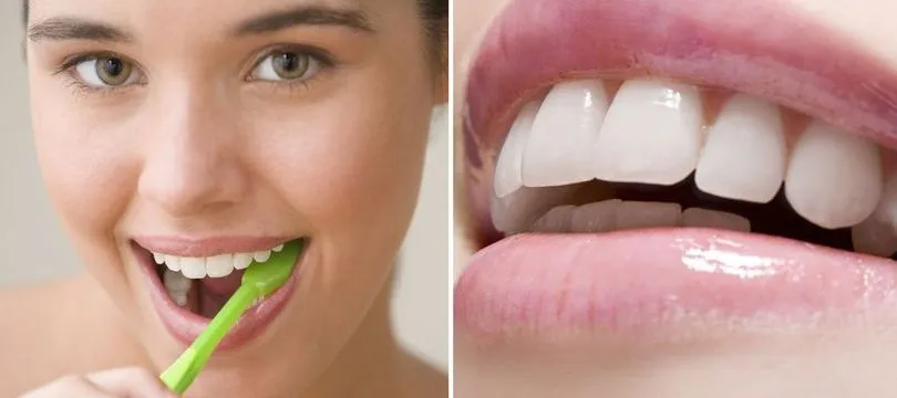 /img/34804-teeth-whitening-spring-tx-dentist-checkup.webp