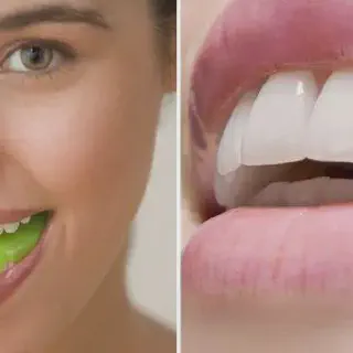 /img/34804-teeth-whitening-spring-tx-dentist-checkup.webp