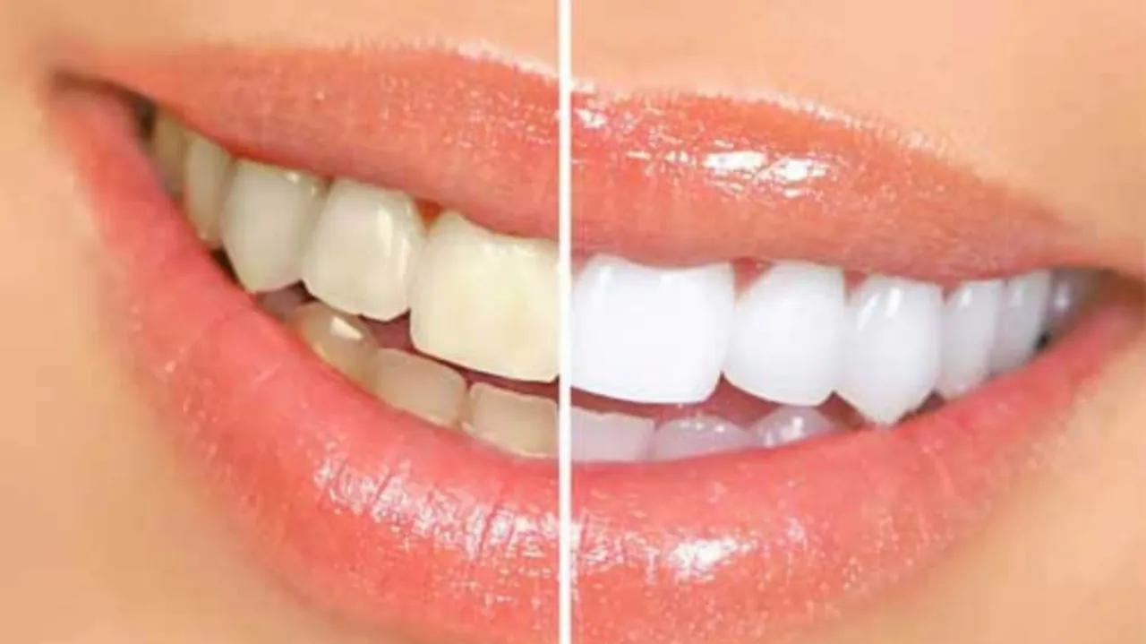 /img/34805-dentist-consultation.webp