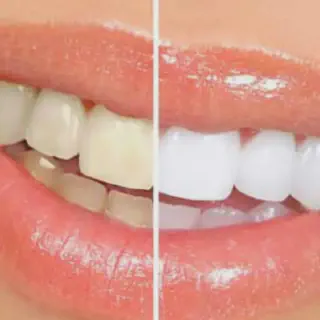 /img/34805-dentist-consultation.webp