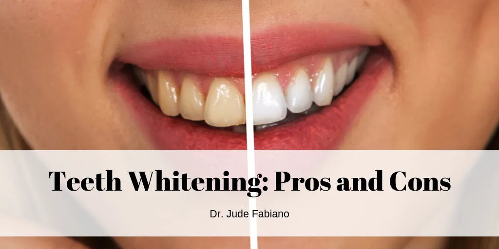 34805 professional teeth whitening