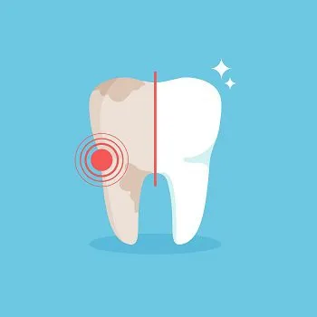 34805 teeth sensitivity